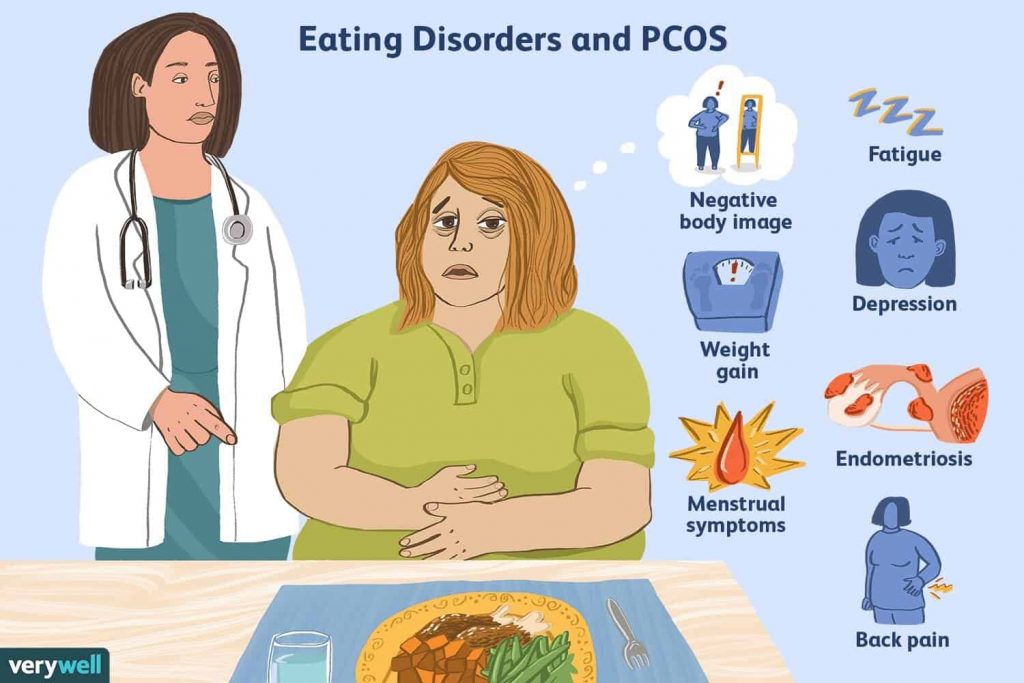 What is polycystic ovarian syndrome
