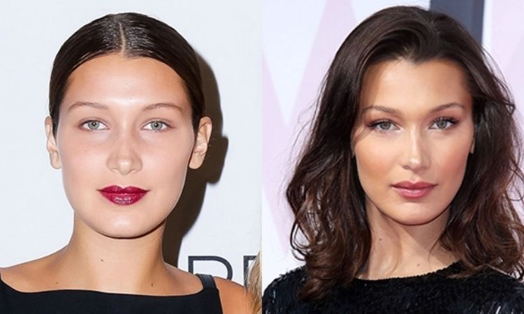 Bella Hadid Nose Job