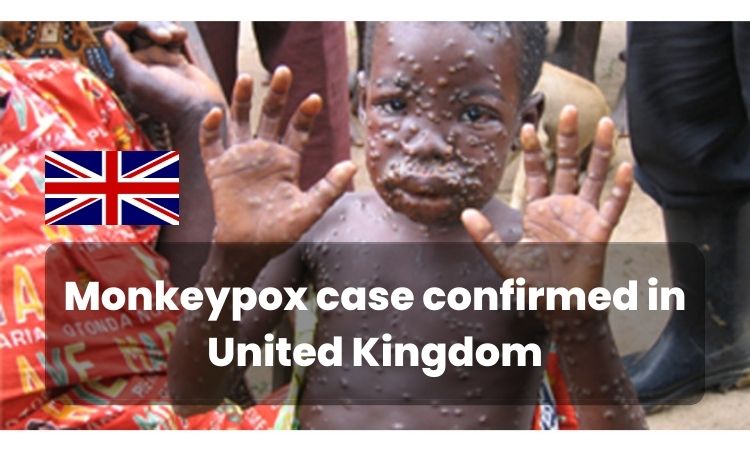 What is Monkeypox Check Symptoms, Prevention, Treatment and History of the Monkeypox