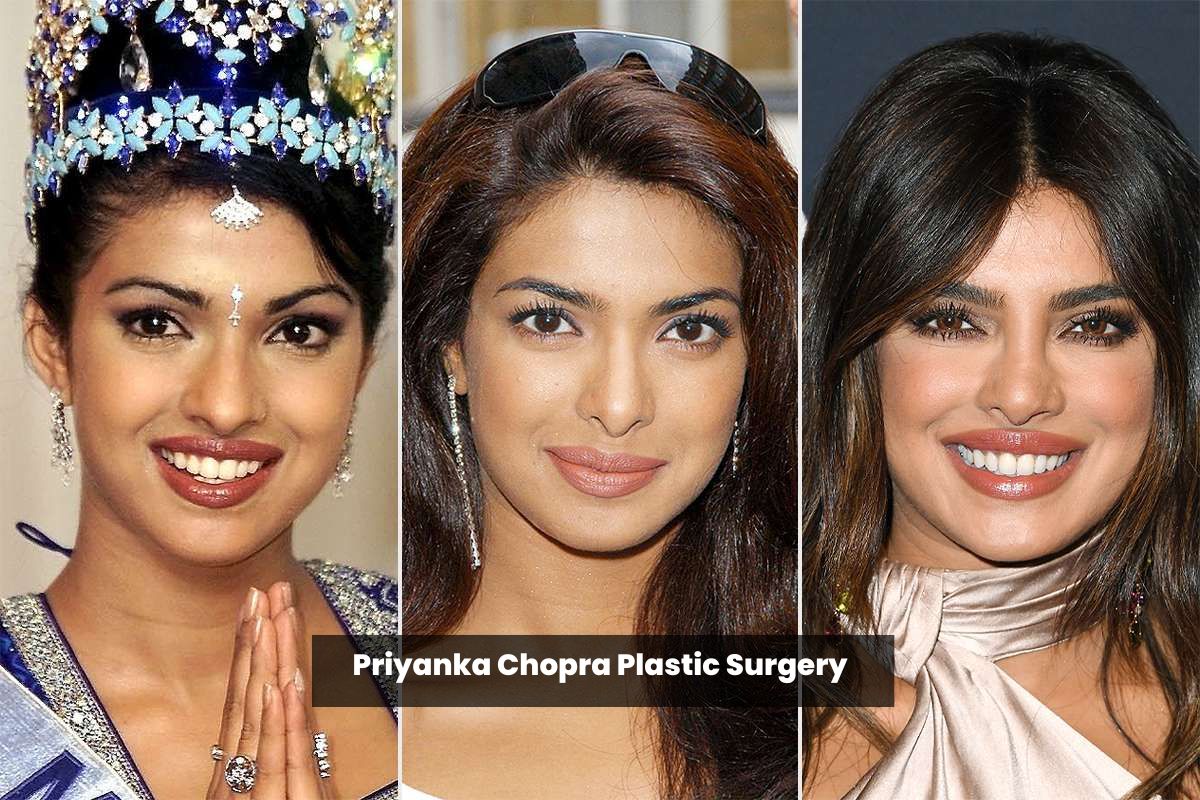 Priyanka Chopra Plastic Surgery
