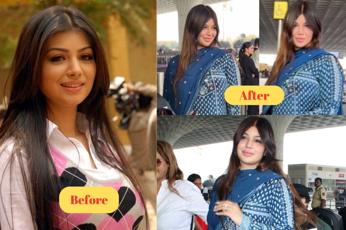 Ayesha Takia Plastic Surgery before after